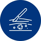 Best Cancer Surgery Hospital in Indore